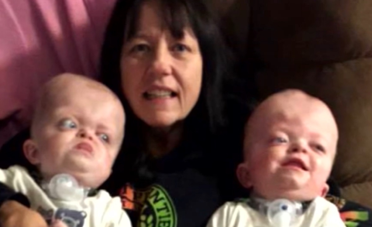 Une infirmire adopte deux jumeaux abandonns parce qu'ils sont atteints d'une maladie rare