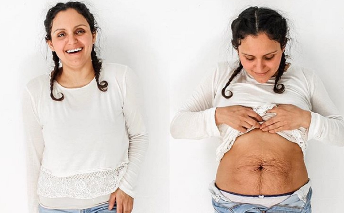 Une maman de 5 enfants exhibe firement son ventre pour dmontrer la vraie beaut d'une femme